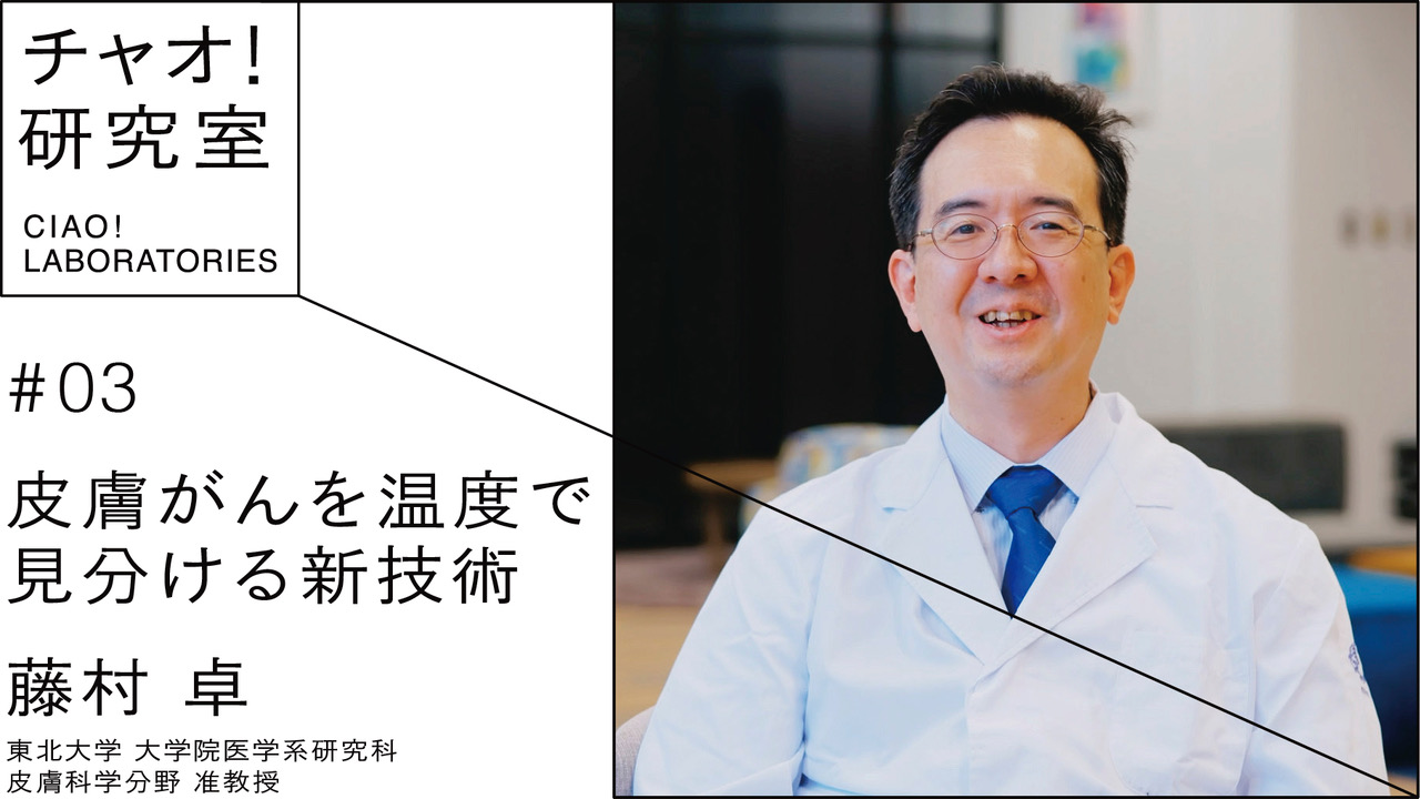 皮膚がんを温度で見分ける新技術