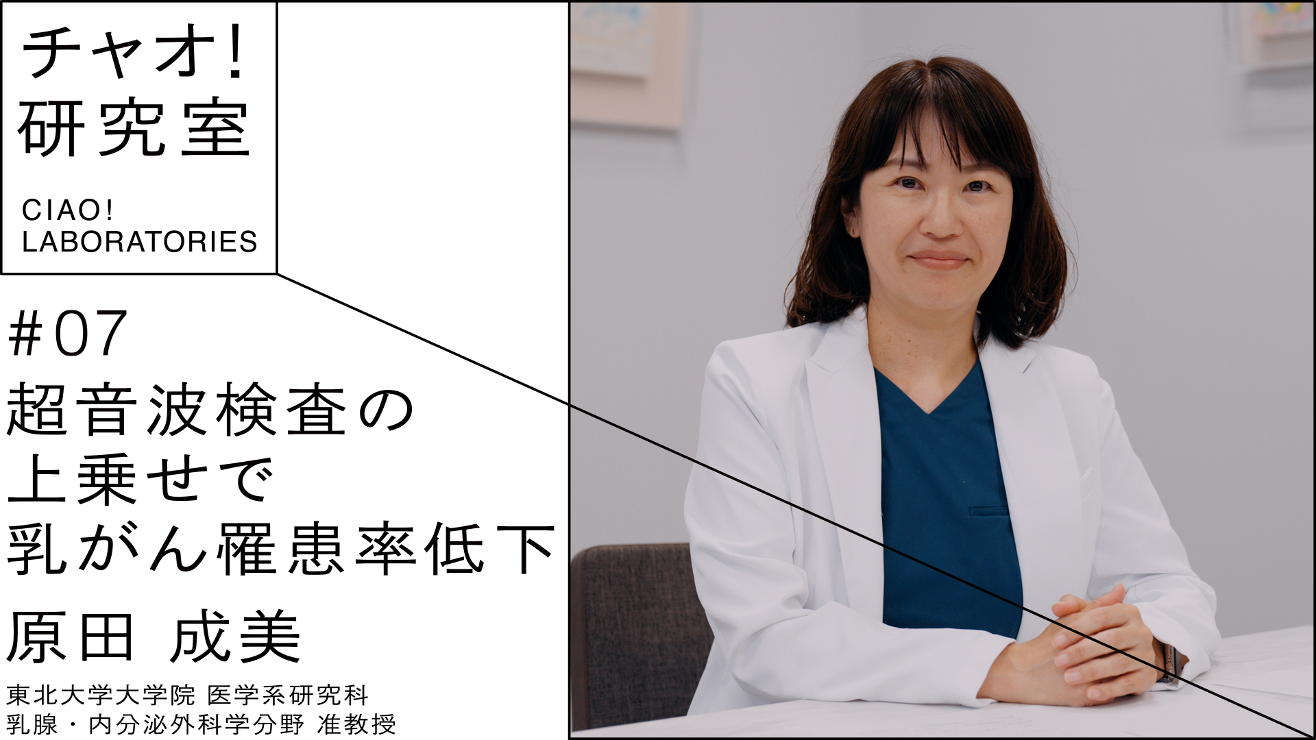 超音波検査の上乗せで乳がん罹患率低下