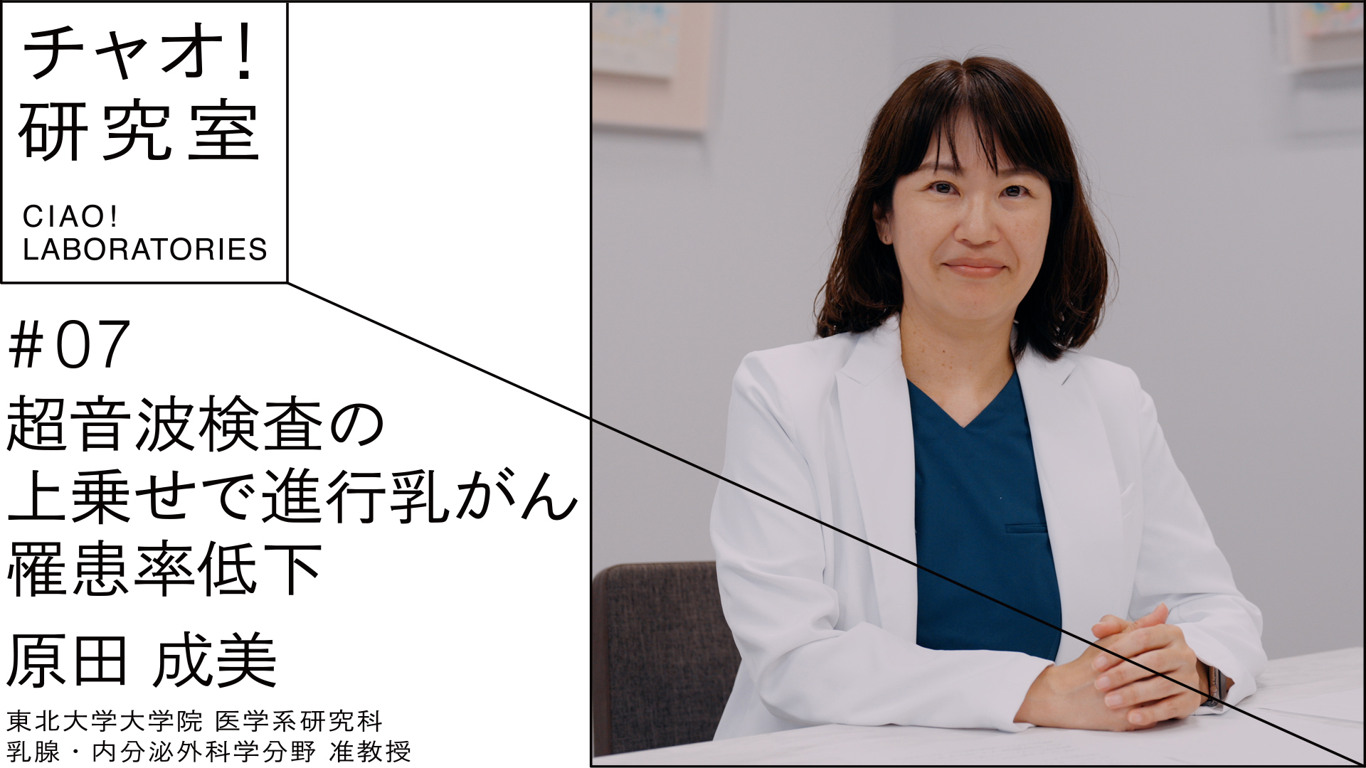超音波検査の上乗せで進行乳がん罹患率低下